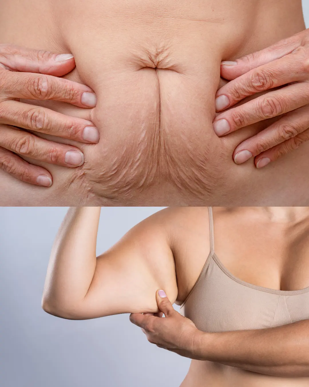 Entrenamiento flacidez